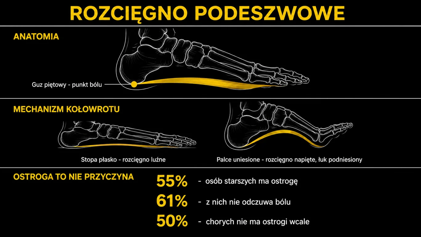 Infografika: zapalenie rozcięgna podeszwowego – anatomia rozcięgna, mechanizm kołowrotu, punkt bólu przy guzie piętowym oraz porównanie ostrogi piętowej z fascjopatią